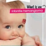 what is infantile hemangioma brochure